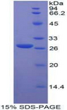 FGFRL1 Protein - Recombinant Fibroblast Growth Factor Receptor Like Protein 1 By SDS-PAGE