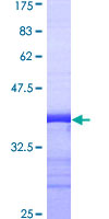 FGG / Fibrinogen Gamma Protein - 12.5% SDS-PAGE Stained with Coomassie Blue.