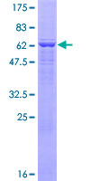 FGGY Protein - 12.5% SDS-PAGE of human FLJ10986 stained with Coomassie Blue