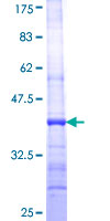 FGGY Protein - 12.5% SDS-PAGE Stained with Coomassie Blue.