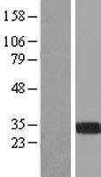 FGL1 / Hepassocin Protein - Western validation with an anti-DDK antibody * L: Control HEK293 lysate R: Over-expression lysate