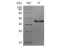FGL1 / Hepassocin Protein - Recombinant Human FGL1 (C-Avi-6His) Biotinylated