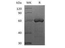 FGL1 / Hepassocin Protein - Recombinant Human FGL1 (C-Fc-Avi) Biotinylated
