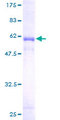 FGL1 / Hepassocin Protein - 12.5% SDS-PAGE of human FGL1 stained with Coomassie Blue