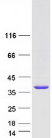 FGL1 / Hepassocin Protein - Purified recombinant protein FGL1 was analyzed by SDS-PAGE gel and Coomassie Blue Staining