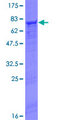 FGL2 Protein - 12.5% SDS-PAGE of human FGL2 stained with Coomassie Blue
