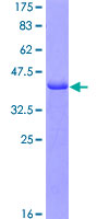 FGL2 Protein - 12.5% SDS-PAGE Stained with Coomassie Blue.