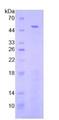 FGL2 Protein - Recombinant Fibrinogen Like Protein 2 By SDS-PAGE