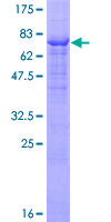 FGR Protein - 12.5% SDS-PAGE of human FGR stained with Coomassie Blue