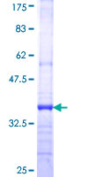 FGR Protein - 12.5% SDS-PAGE Stained with Coomassie Blue.