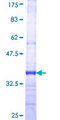 FGR Protein - 12.5% SDS-PAGE Stained with Coomassie Blue.