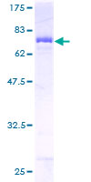 FH / Fumarase / MCL Protein - 12.5% SDS-PAGE of human FH stained with Coomassie Blue