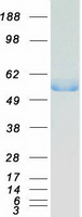 FH / Fumarase / MCL Protein - Purified recombinant protein FH was analyzed by SDS-PAGE gel and Coomassie Blue Staining