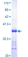 FHIT Protein - 12.5% SDS-PAGE Stained with Coomassie Blue.