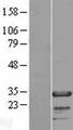 FHL2 Protein - Western validation with an anti-DDK antibody * L: Control HEK293 lysate R: Over-expression lysate