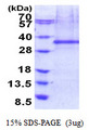 FHL2 Protein