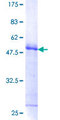 FHL3 Protein - 12.5% SDS-PAGE of human FHL3 stained with Coomassie Blue