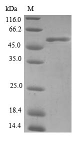 FHL3 Protein - (Tris-Glycine gel) Discontinuous SDS-PAGE (reduced) with 5% enrichment gel and 15% separation gel.