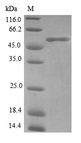 FHL3 Protein - (Tris-Glycine gel) Discontinuous SDS-PAGE (reduced) with 5% enrichment gel and 15% separation gel.