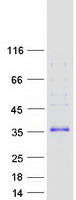 FHL3 Protein - Purified recombinant protein FHL3 was analyzed by SDS-PAGE gel and Coomassie Blue Staining