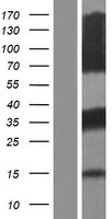 FHL5 Protein - Western validation with an anti-DDK antibody * L: Control HEK293 lysate R: Over-expression lysate