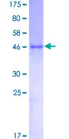 FHL5 Protein - 12.5% SDS-PAGE of human FHL5 stained with Coomassie Blue
