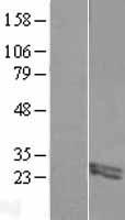 FIBIN Protein - Western validation with an anti-DDK antibody * L: Control HEK293 lysate R: Over-expression lysate