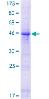 FIBIN Protein - 12.5% SDS-PAGE of human FIBIN stained with Coomassie Blue