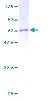 Fibulin-3 / EFEMP1 Protein - 12.5% SDS-PAGE of human EFEMP1 stained with Coomassie Blue