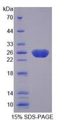 Fibulin-3 / EFEMP1 Protein - Recombinant Fibulin 3 By SDS-PAGE