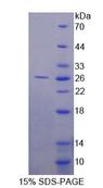 Fibulin-3 / EFEMP1 Protein - Recombinant Fibulin 3 (FBLN3) by SDS-PAGE