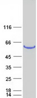 Fibulin-3 / EFEMP1 Protein - Purified recombinant protein EFEMP1 was analyzed by SDS-PAGE gel and Coomassie Blue Staining