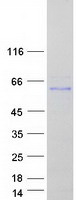 Fibulin-3 / EFEMP1 Protein - Purified recombinant protein EFEMP1 was analyzed by SDS-PAGE gel and Coomassie Blue Staining