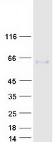 Fibulin-3 / EFEMP1 Protein - Purified recombinant protein EFEMP1 was analyzed by SDS-PAGE gel and Coomassie Blue Staining