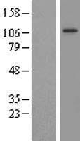 FIG4 Protein - Western validation with an anti-DDK antibody * L: Control HEK293 lysate R: Over-expression lysate