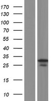 FIGLA Protein - Western validation with an anti-DDK antibody * L: Control HEK293 lysate R: Over-expression lysate