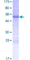 FIGLA Protein - 12.5% SDS-PAGE of human FIGLA stained with Coomassie Blue