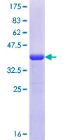 FIGLA Protein - 12.5% SDS-PAGE Stained with Coomassie Blue.