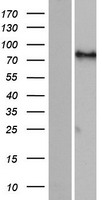 FIGN / Fidgetin Protein - Western validation with an anti-DDK antibody * L: Control HEK293 lysate R: Over-expression lysate