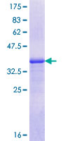 FIGN / Fidgetin Protein - 12.5% SDS-PAGE Stained with Coomassie Blue.