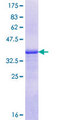 FIGN / Fidgetin Protein - 12.5% SDS-PAGE Stained with Coomassie Blue.