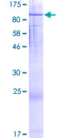 FIGNL1 Protein - 12.5% SDS-PAGE of human FIGNL1 stained with Coomassie Blue