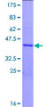FIS1 Protein - 12.5% SDS-PAGE of human FIS1 stained with Coomassie Blue