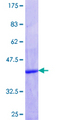 FIS1 Protein - 12.5% SDS-PAGE Stained with Coomassie Blue.
