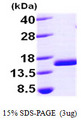 FIS1 Protein