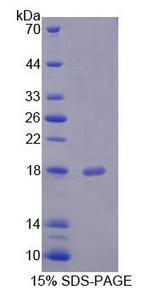 FIS1 Protein - Recombinant Fission 1 By SDS-PAGE
