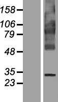 FITM1 Protein - Western validation with an anti-DDK antibody * L: Control HEK293 lysate R: Over-expression lysate