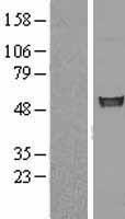 FIZ1 Protein - Western validation with an anti-DDK antibody * L: Control HEK293 lysate R: Over-expression lysate