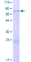 FJX1 Protein - 12.5% SDS-PAGE of human FJX1 stained with Coomassie Blue