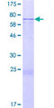 FJX1 Protein - 12.5% SDS-PAGE of human FJX1 stained with Coomassie Blue